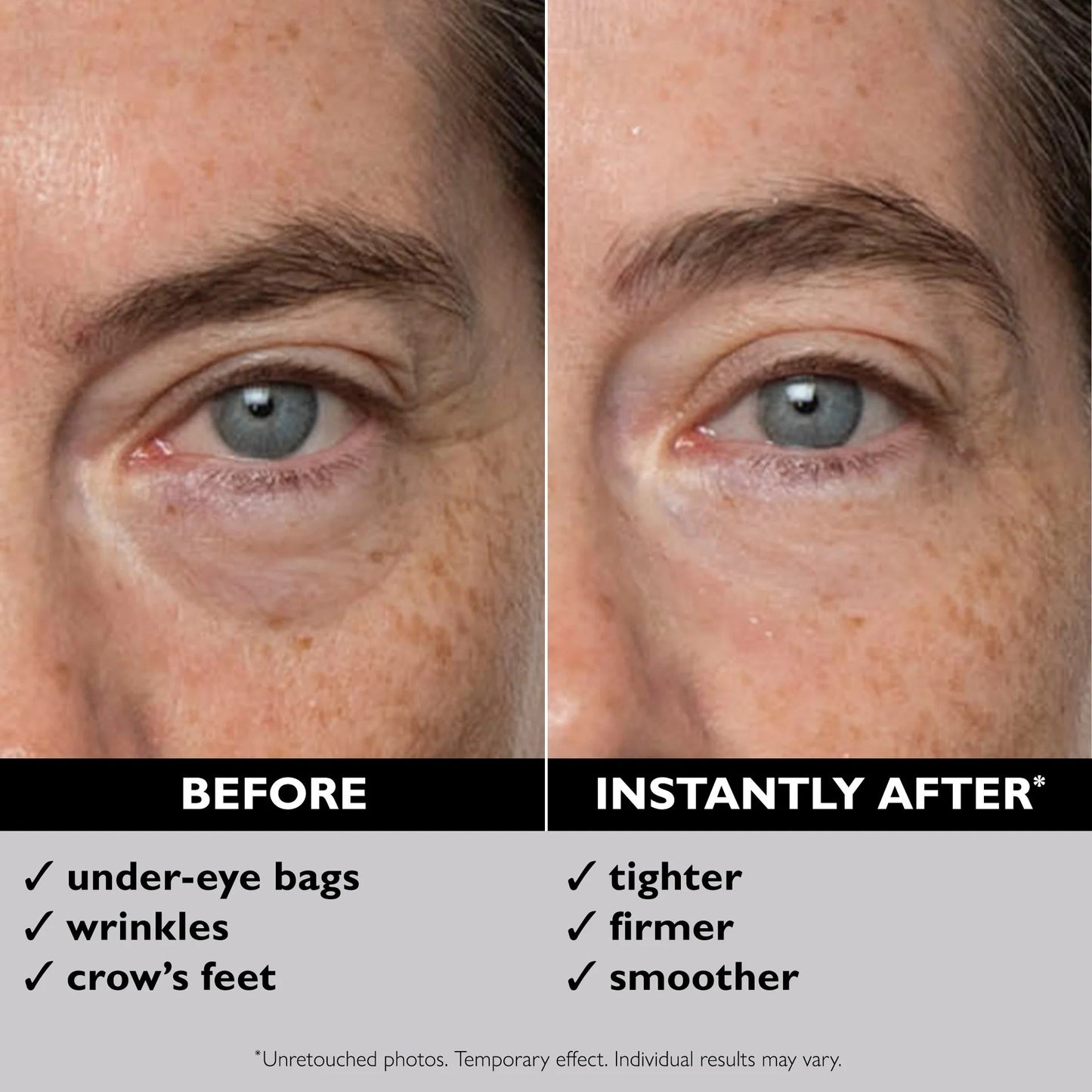 Instant Tight Eyes – Original Formula
