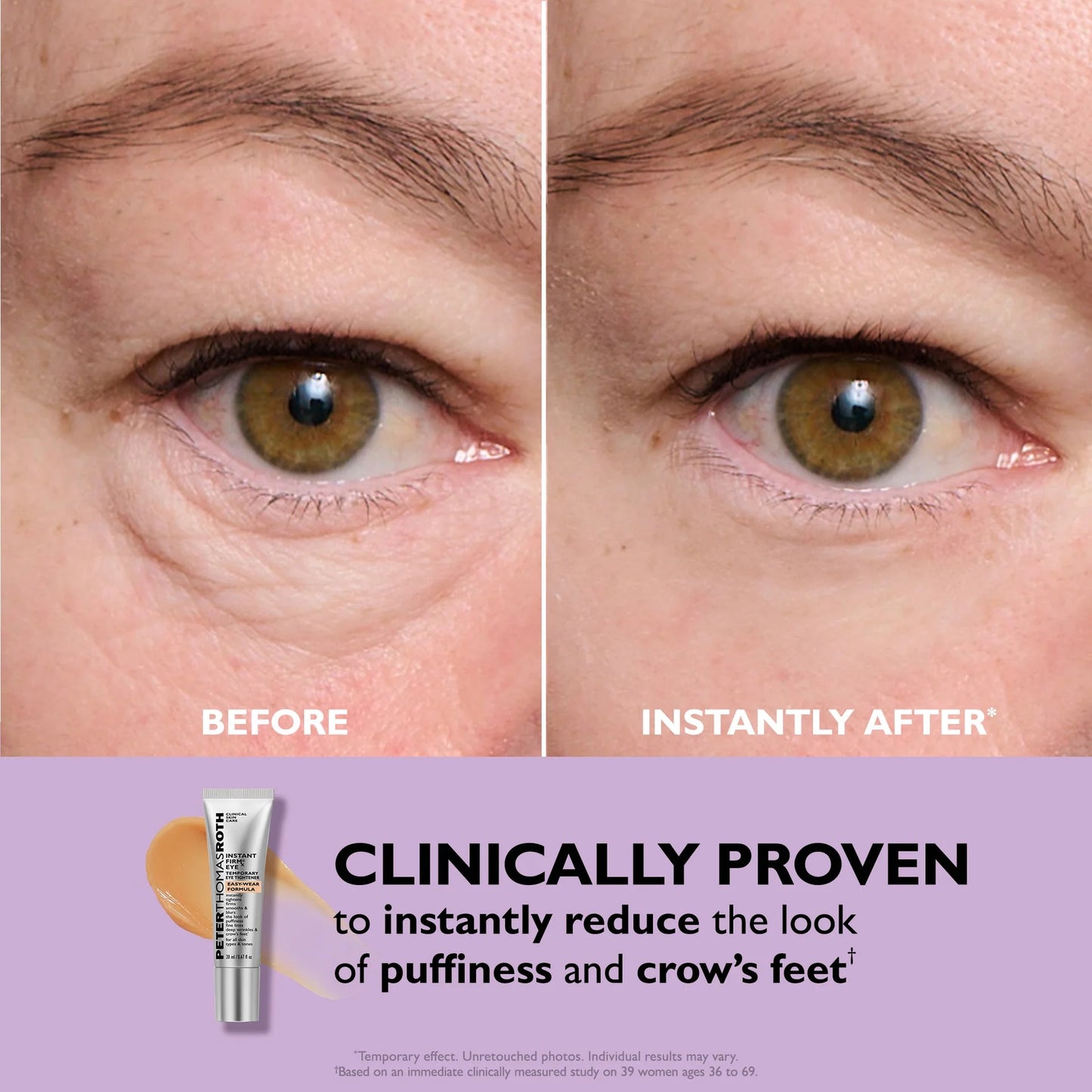 Instant Tight Eyes – No Irritation, Real Results