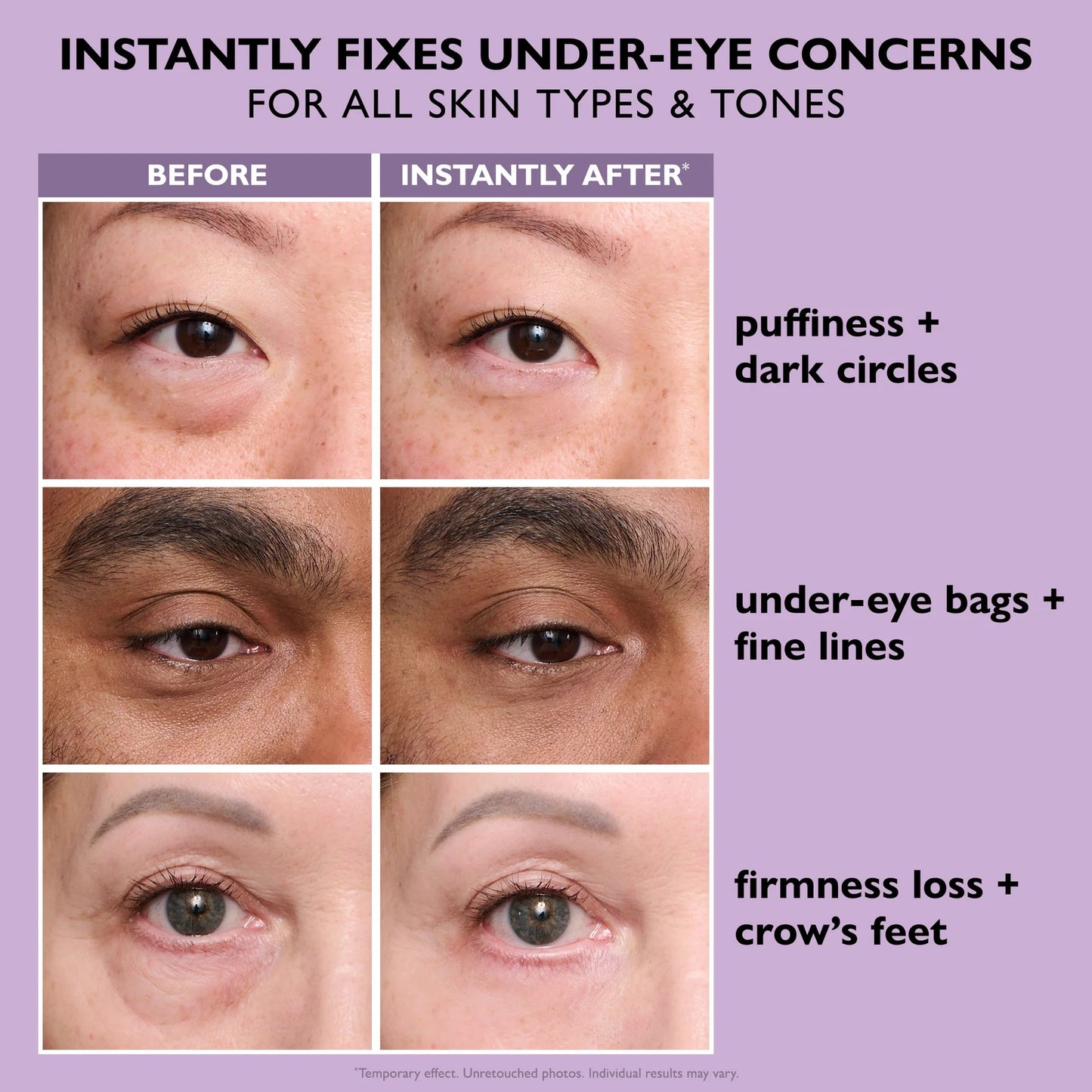 Instant Tight Eyes – No Irritation, Real Results