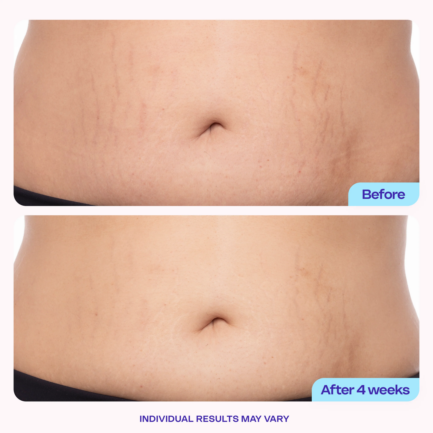 Tighten & Smooth Belly Firming Cream